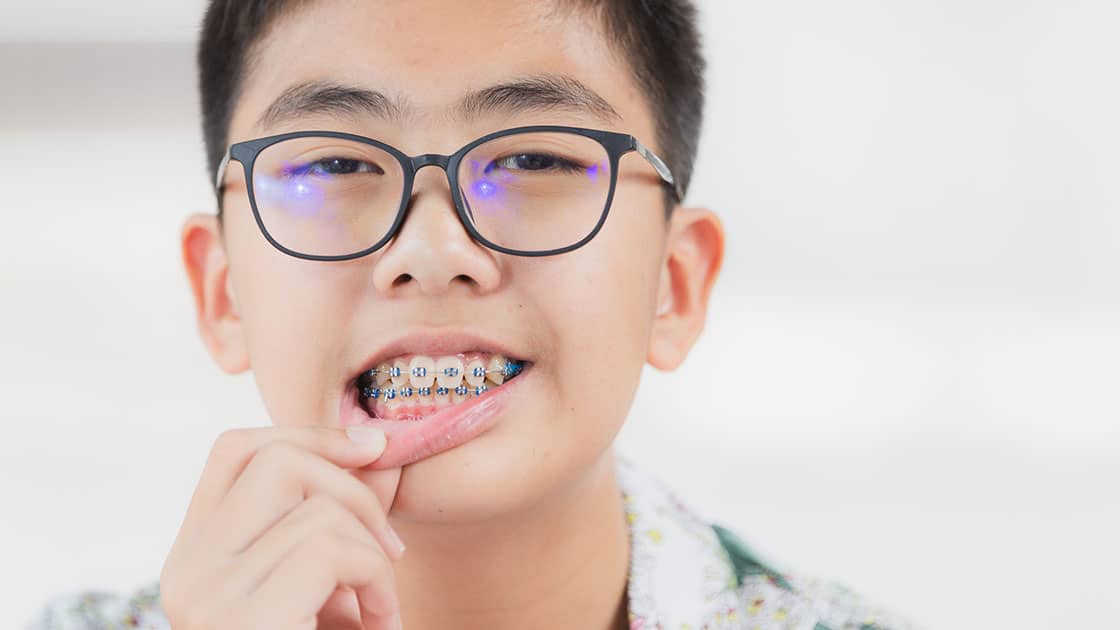 First Day in Braces Patient